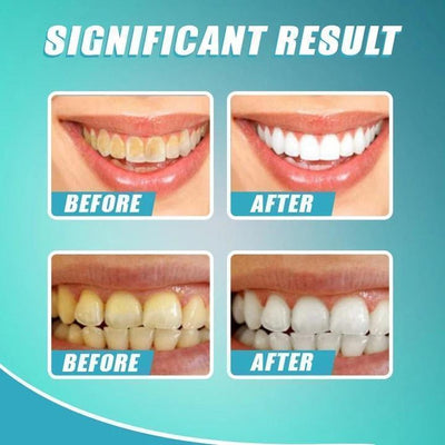 WhiteSmile | Whitening-Zahnpasta für weißere Zähne (1+1 GRATIS)