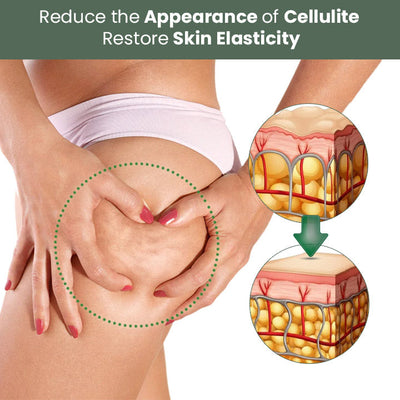 Anti Cellulitis Crème™ | Reduziert die Sichtbarkeit von Cellulite (1+1 GRATIS)