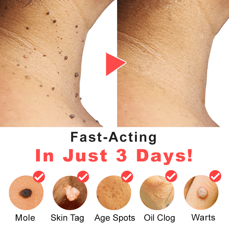 SkinPatch | Pflaster zur Entfernung von Hautflecken (1+1 GRATIS PAKETE)