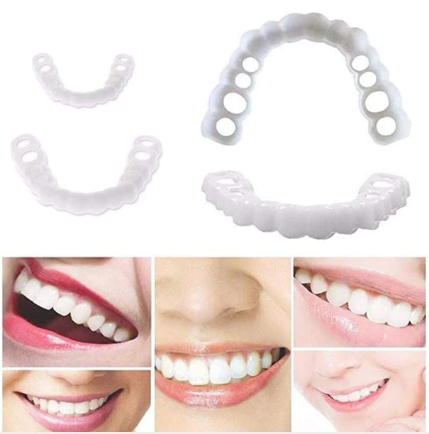 Weiße Zähne Facings | Klickbar