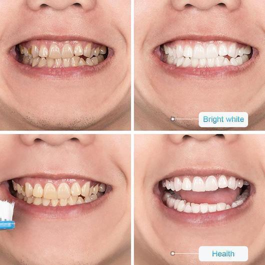 WhiteSmile | Whitening-Zahnpasta für weißere Zähne (1+1 GRATIS)